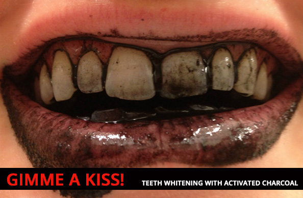 Teeth whitening with activated charcoal: does it work?